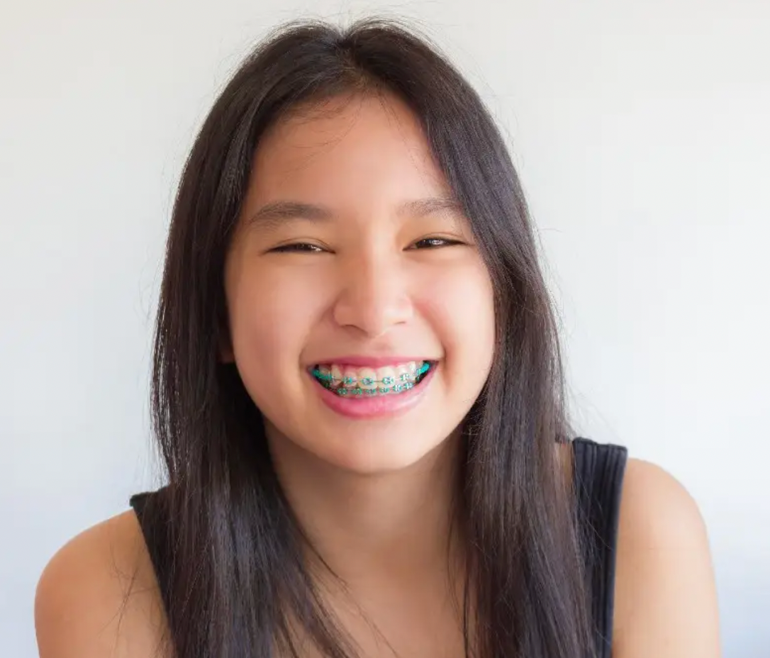 Kids Braces